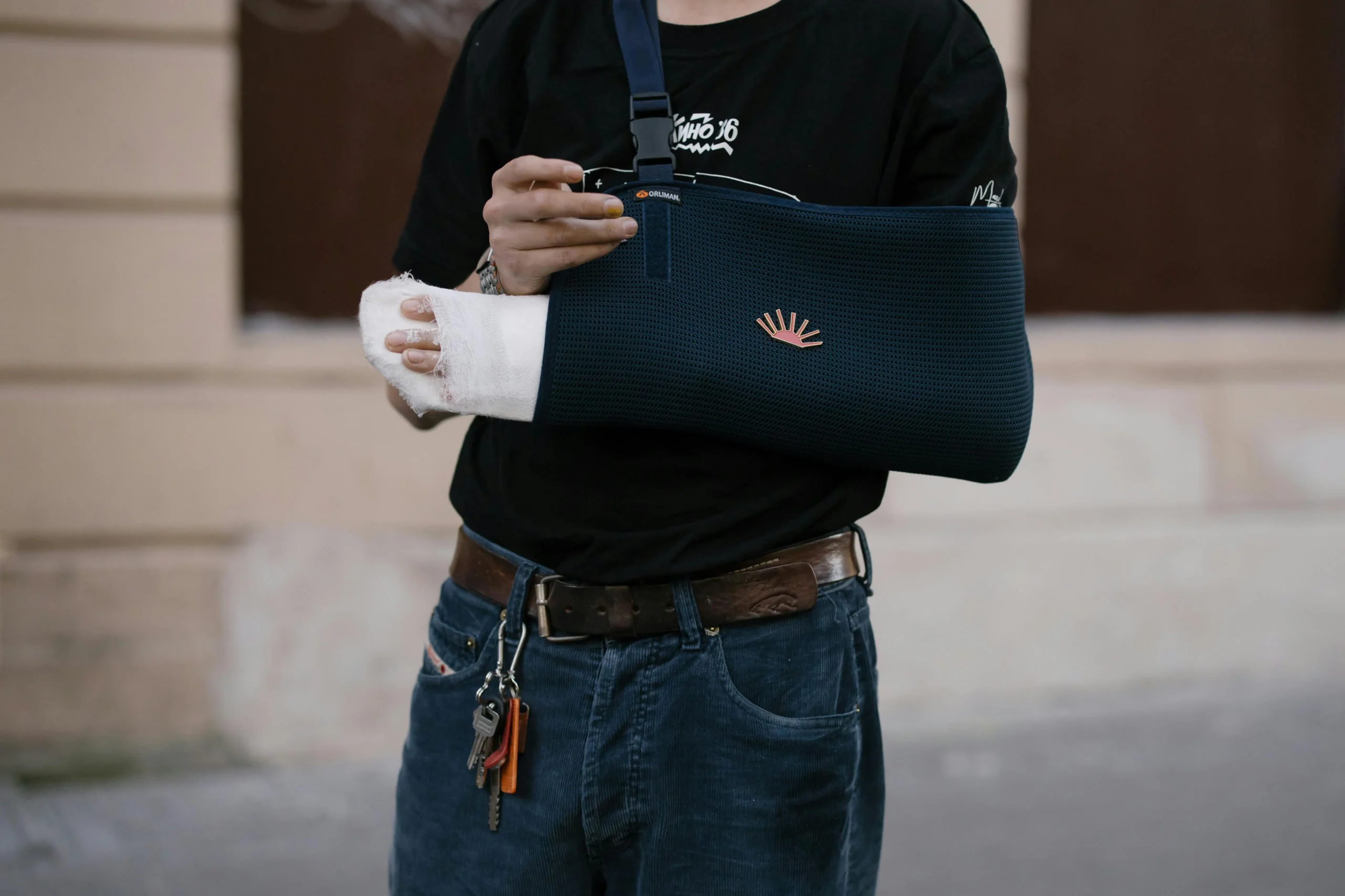 Distal humerus and olecranon fracture