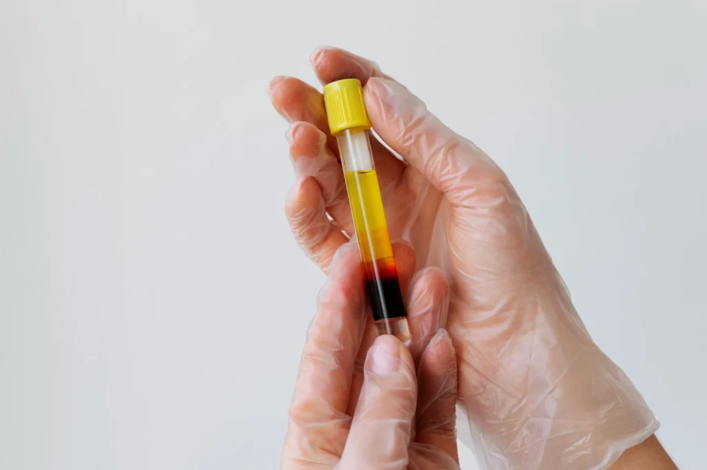 PRP and Non-Surgical Orthopedic Treatments