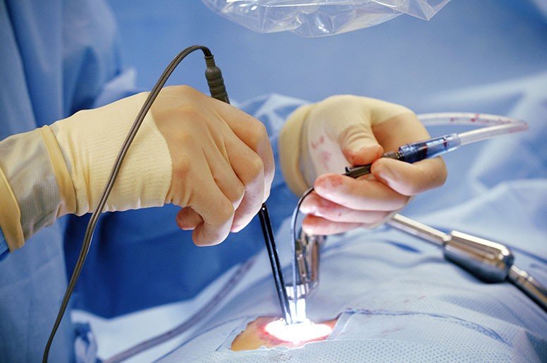 Minimally Invasive