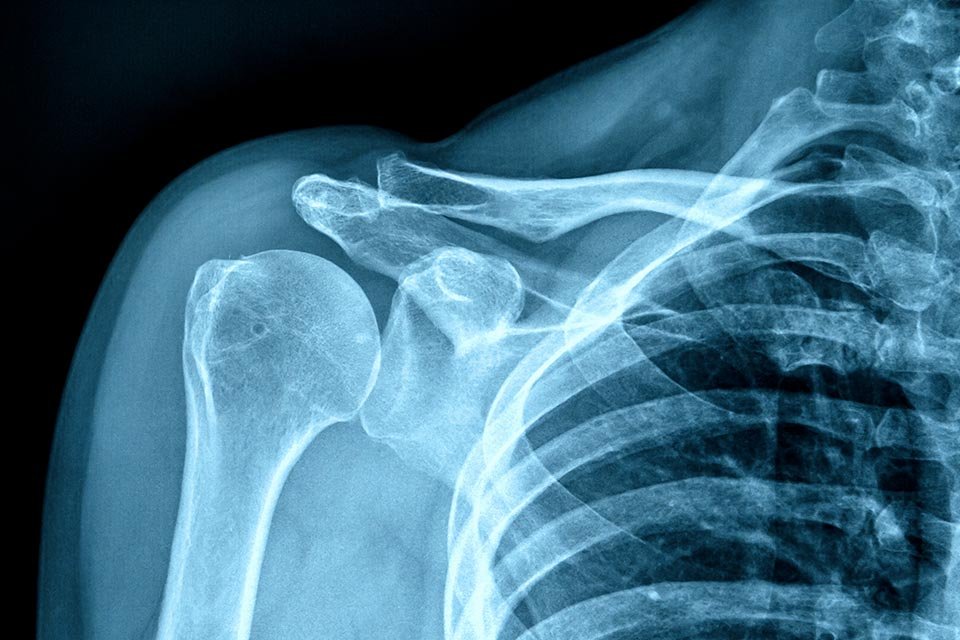 X-rays