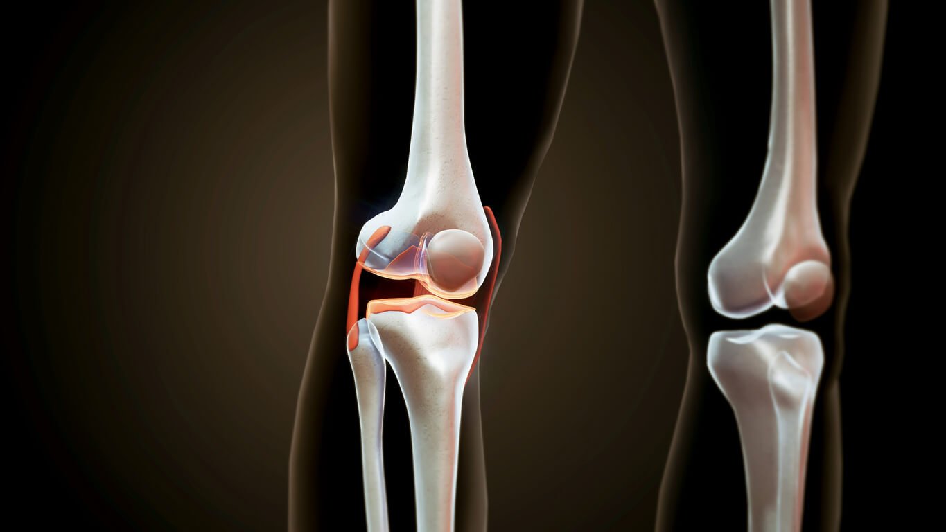 Ligament injury medical visual 1