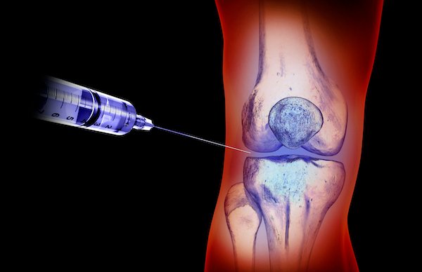 PRP & Stem Cell Therapy