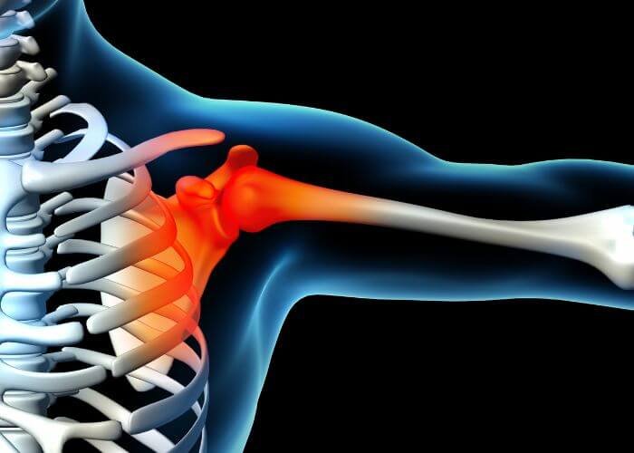 Fracture Dislocation