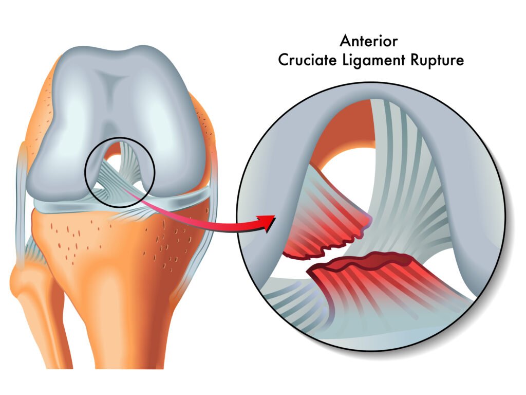 Arthroscopic evaluation