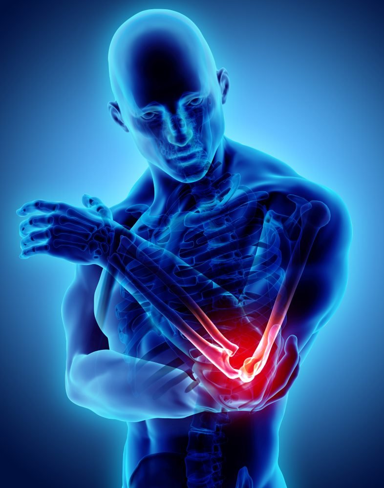 Radius and ulna fractures