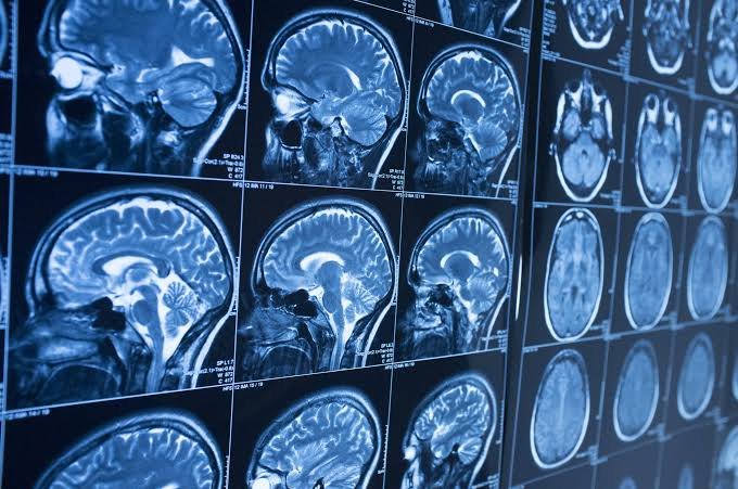 MRI / Radiology