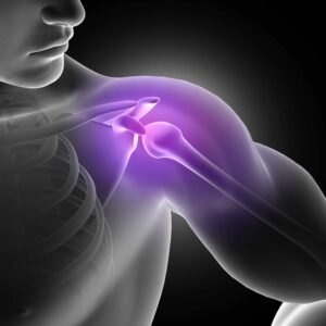 Partial Dislocation