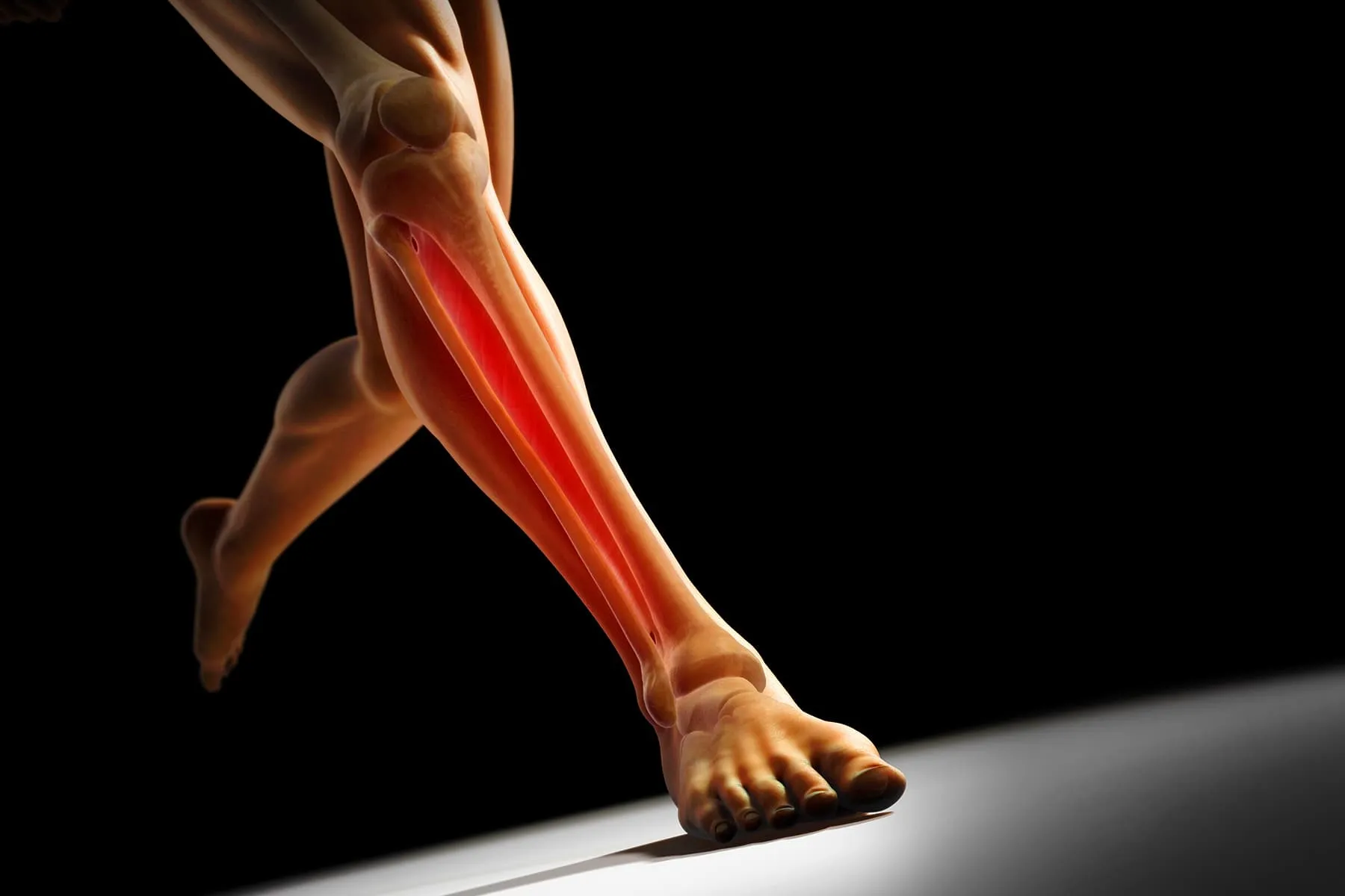Overuse Injuries