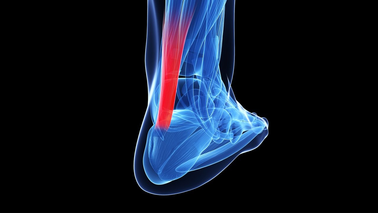 Tendon Injuries