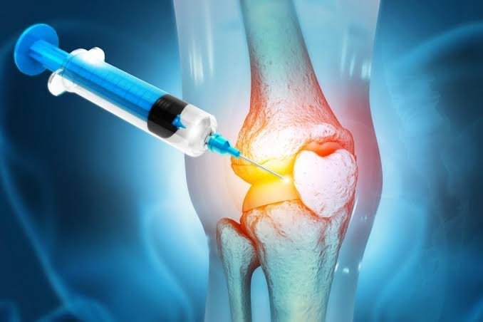 PRP Treatment Procedure