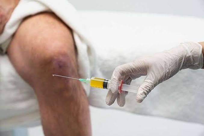 Scientific PRP Preparation