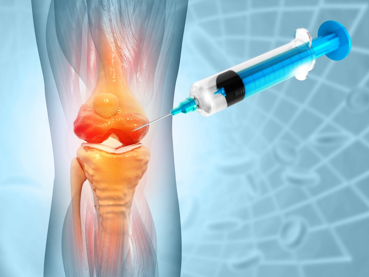 Tissue Repair Phase
